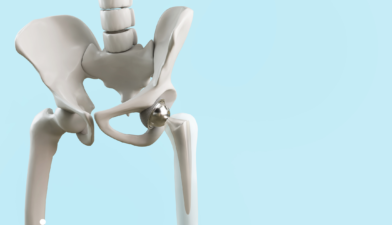 Benefits and Risks of Hip Replacement